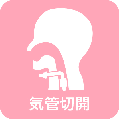 気管切開